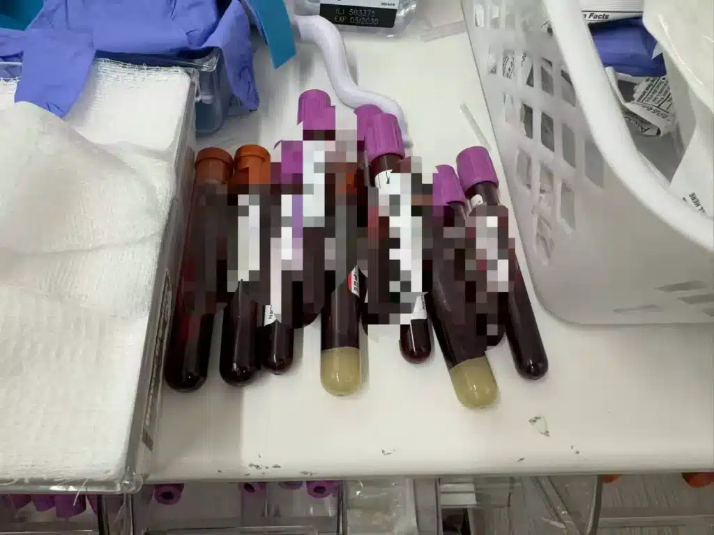 Blood collection tubes prepared for hormone monitoring during an IVF stimulation cycle